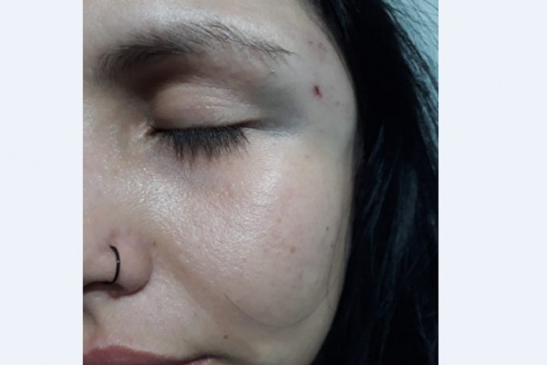 Estefany Julieth fue víctima de una brutal agresión