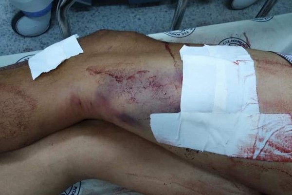 Versiones de la policía no 'cuadran' ¿están omitiendo algo?