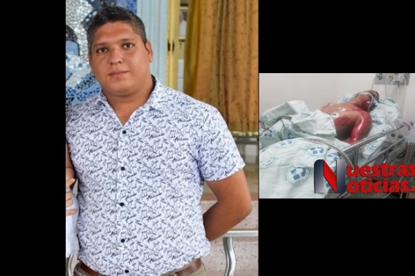 En medio de un rezo para la 'mala suerte' murió quemado