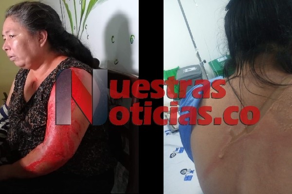 Atacada con un agente químico por segunda vez