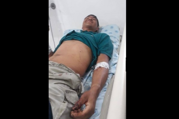 Atacado a machete al ser sorprendido en la 'cama' con su patrona