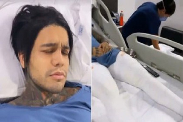 Accidente dejó sin caminar por cinco meses a polémico influencer