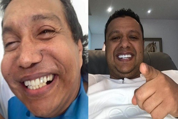 Rafael Santos confesó si diamantes de sus dientes son herencia de Diomedes