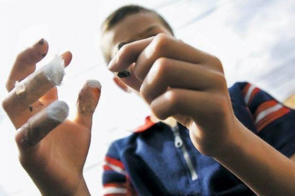 Dos quemados por pólvora la noche de las velitas en el Huila