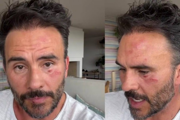 Ni los personajes de la farándula se salvan de la delincuencia en Colombia