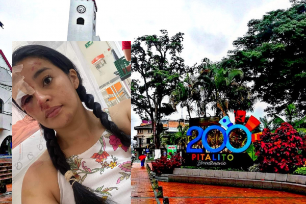 Mujer fue maltratada salvajemente por robarle la moto en Pitalito